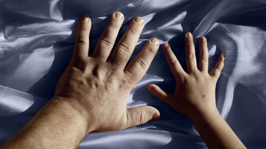 Giant Challenges: Navigating Acromegaly’s Impact on Health and&nbsp;Well-being